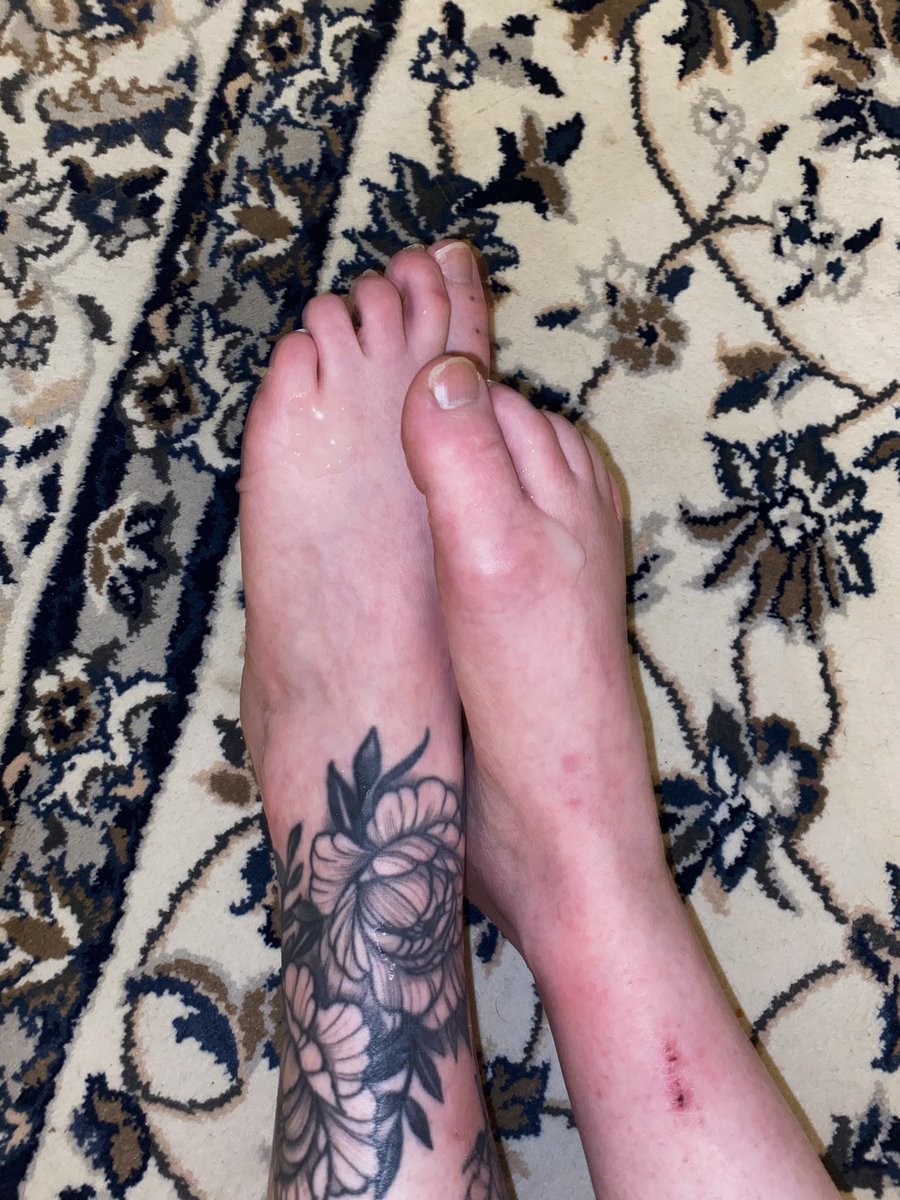 LyaMagicalBE's tweet photo. wetfeet 💦

#feetcontent #wetfeet #feet_pic #feetlover • voetjes • feetsell https://t.co/U3yaS0hSBu
