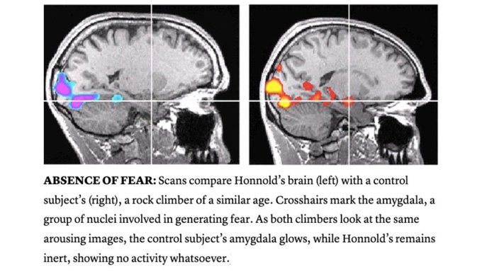 In the documentary 'Free Solo,' neuroscientists perform an fMRI scan of rock climber Alex Honnold’s brain.

The neuroscientists conclude that Honnold’s brain doesn't respond to fear stimuli like a 'normal' brain.

“I find that slightly irritating,” Honnold later said. 'Because...…