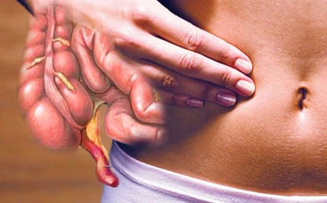CirujanoGZ's tweet photo. Dentro del año después de haber sido tratados por #apendicitis, El riesgo de #cáncer de colon de los pacientes casi se CUADRUPLICÓ. Dado el corto intervalo entre la apendicitis y el cáncer, la apendicitis es 1 señal de advertencia temprana de cáncer de colon, no 1 causa del mismo https://t.co/DV2dT3QoBC