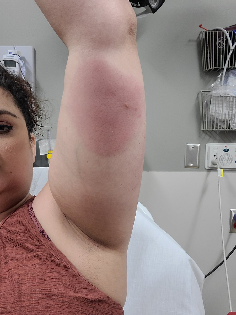 LGarc23's tweet photo. 1/3 @IHGhotels and @IHGCorporate it would be great if someone could actually respond to an email regarding a horrible experience at your @Staybridge in Peoria, IL on May 5th. In case you need a reminder, it's the one with photo evidence of the bed bugs I got bit by. https://t.co/V4VJW79uyn