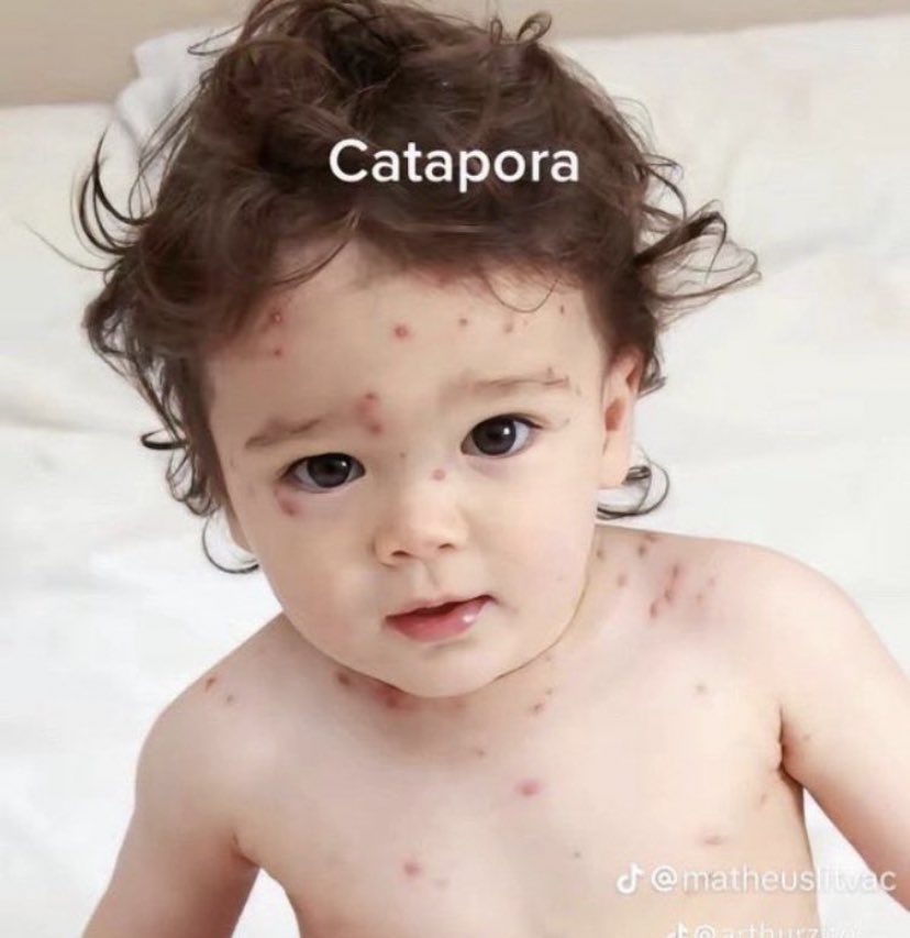 samengo_ofc's tweet photo. Catapora // cataporra nenhuma https://t.co/ew2vVQrOVC