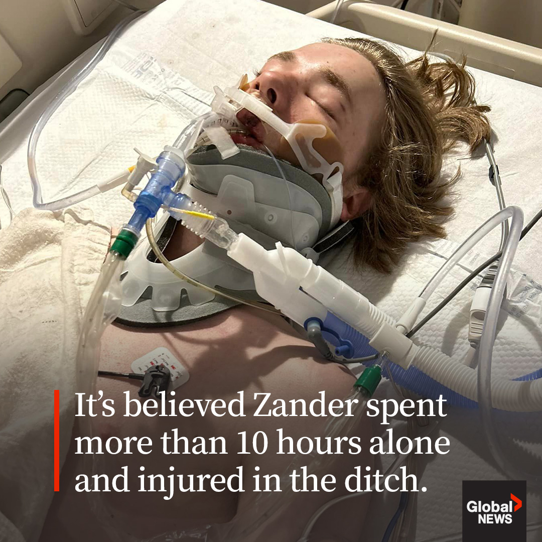 A 15-year-old Alberta boy faces an arduous recovery after suffering severe injuries in a crash and spending an entire night on the side of the road earlier this month.

READ MORE: trib.al/frsLro6
