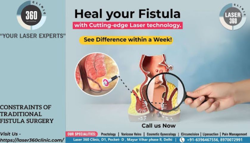 #Lasertreatment is better to have perfect #lasersurgeryforfistula and get rid of the #fistula without complications.
tinyurl.com/2s39z9pr
#fistulasurgery
#fistulatreatment
#analfistulatreatment
#laserfistulatreatment
#laserfistulasurgery