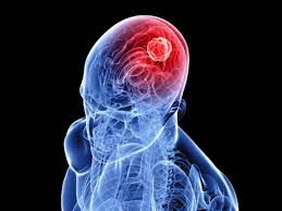 ortega_copado's tweet photo. La 2ª causa de muerte en el mundo: el #ictus 🧠
El #Pockit, desarrollado por los Hnos. #Ladrera, supone diagnosticarlo rápidamente cuando el paciente lo está sufriendo, pudiendo reducirse los posibles daños cerebrales 🙏🏼🤕
@AlejandroSanz
➡️ https://t.co/Y6LMDEzbjF https://t.co/iI4H7Kcbwb