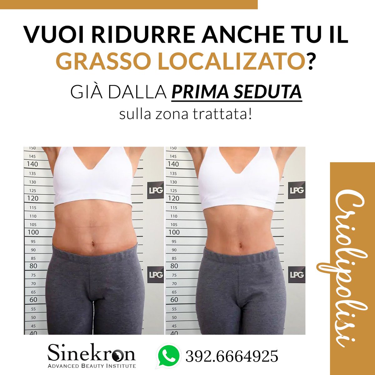 _Sinekron_'s tweet image. Come fare per #eliminare il #grasso corporeo? 🤔

Con la #Criolipolisi, una procedura per varie zone del corpo: addome, fianchi, interno braccia, coulottes de cheval e schiena, consulenza #gratuita! 😊

info@sinekron.it – 0825474058
WhatsApp qui bit.ly/3MajmOm