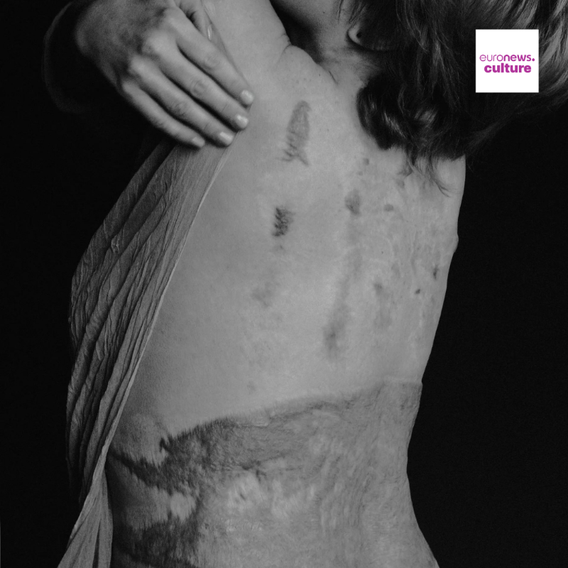 euronewsculture's tweet photo. 28-year-old photographer, @marta_syrko, is from Lviv and wants to change perceptions about disabled people in Ukraine. 🇺🇦

Her "Sculpture Series" shows soldiers in a new light.👇