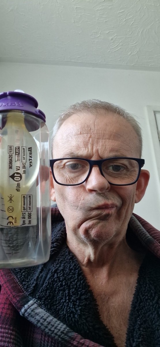 MurraySim6's tweet photo. Day 2. Chemo dose 1. Last day with #baxterthepump 
Looks like 50% gone, at 9am. Don't think Sheldon Unit is open that late!!
#wholenewworld 
#fuckcancer https://t.co/u4SeiJ0dM8