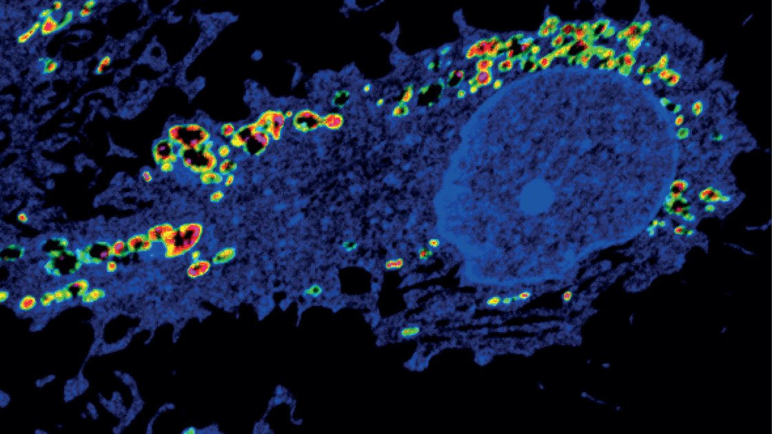 PLOS (@plos) on Twitter photo Learn from researchers <a href="/SMuller_Dunelm/">Sebastian Müller</a>, Stéphanie Solier and Raphaël Rodriguez about septic shock and metastases in this new Your Say Blog post: plos.io/45yqu1o #copper #inflammation #sepsis #CD44 Learn from researchers <a href="/SMuller_Dunelm/">Sebastian Müller</a>, Stéphanie Solier and Raphaël Rodriguez about septic shock and metastases in this new Your Say Blog post: plos.io/45yqu1o #copper #inflammation #sepsis #CD44