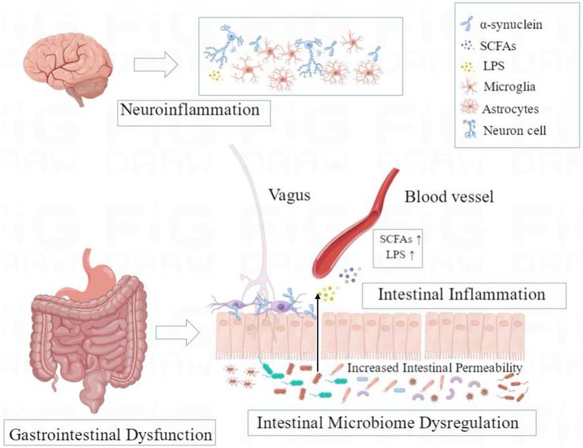 Agingdoc⭐David Barzilai🔔MD PhD MS MBA DipABLM🩺 (@agingdoc1) on Twitter photo The role of the microbiota-gut-brain axis and intestinal microbiome dysregulation in Parkinson’s disease
frontiersin.org/articles/10.33… <a href="/FrontNeurol/">Frontiers - Neurology</a> The role of the microbiota-gut-brain axis and intestinal microbiome dysregulation in Parkinson’s disease
frontiersin.org/articles/10.33… <a href="/FrontNeurol/">Frontiers - Neurology</a>