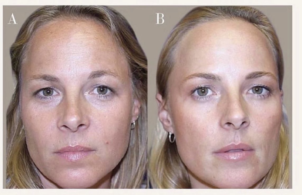 The Cosmetic Lane On Twitter What Does 19 Years Of Anti wrinkle the-cosmetic-lane-on-twitter-what-does-19-years-of-anti-wrinkle