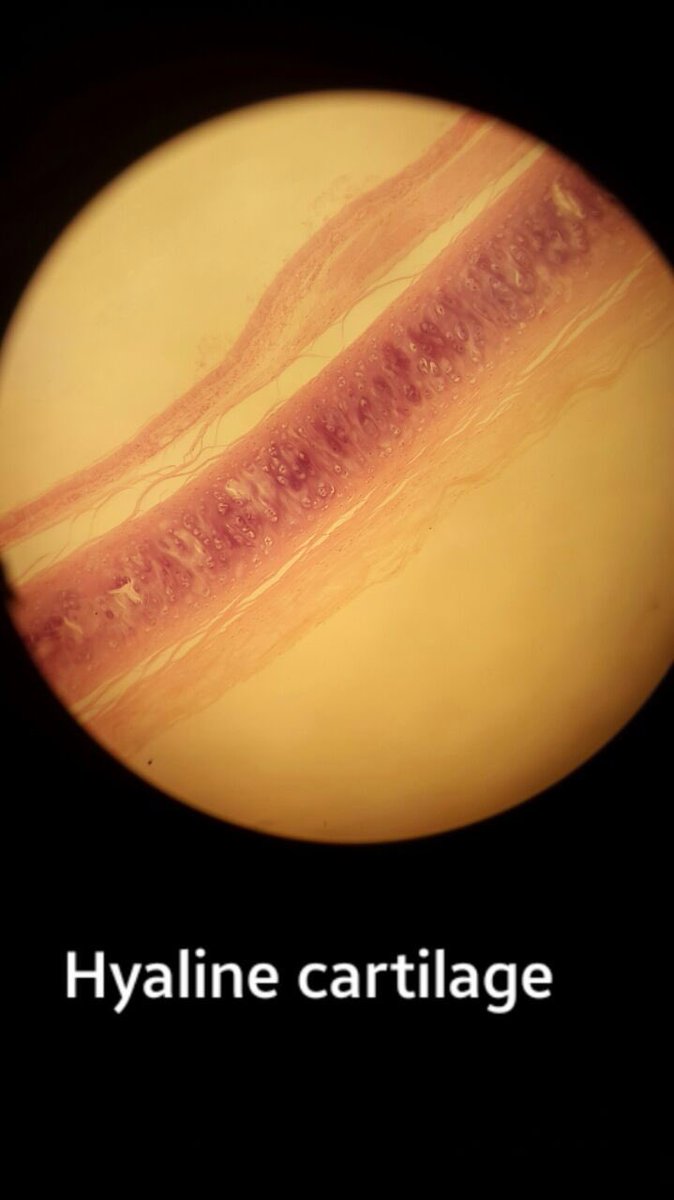 Histology is so unnecessary walahi cos tell me how this is not Saturn