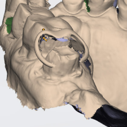 Hallmark Dental Lab tweet media