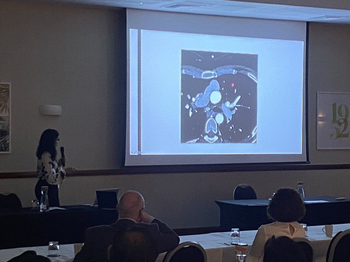 James Shambrook (@james_shambrook) on Twitter photo Great attendance for <a href="/BSCImaging/">BSCI BSCCT</a> congenital cardiac imaging day in Leicester. Program chair Dr Aparna Deshpande talking to us about transposition of the great arteries. Great attendance for <a href="/BSCImaging/">BSCI BSCCT</a> congenital cardiac imaging day in Leicester. Program chair Dr Aparna Deshpande talking to us about transposition of the great arteries.