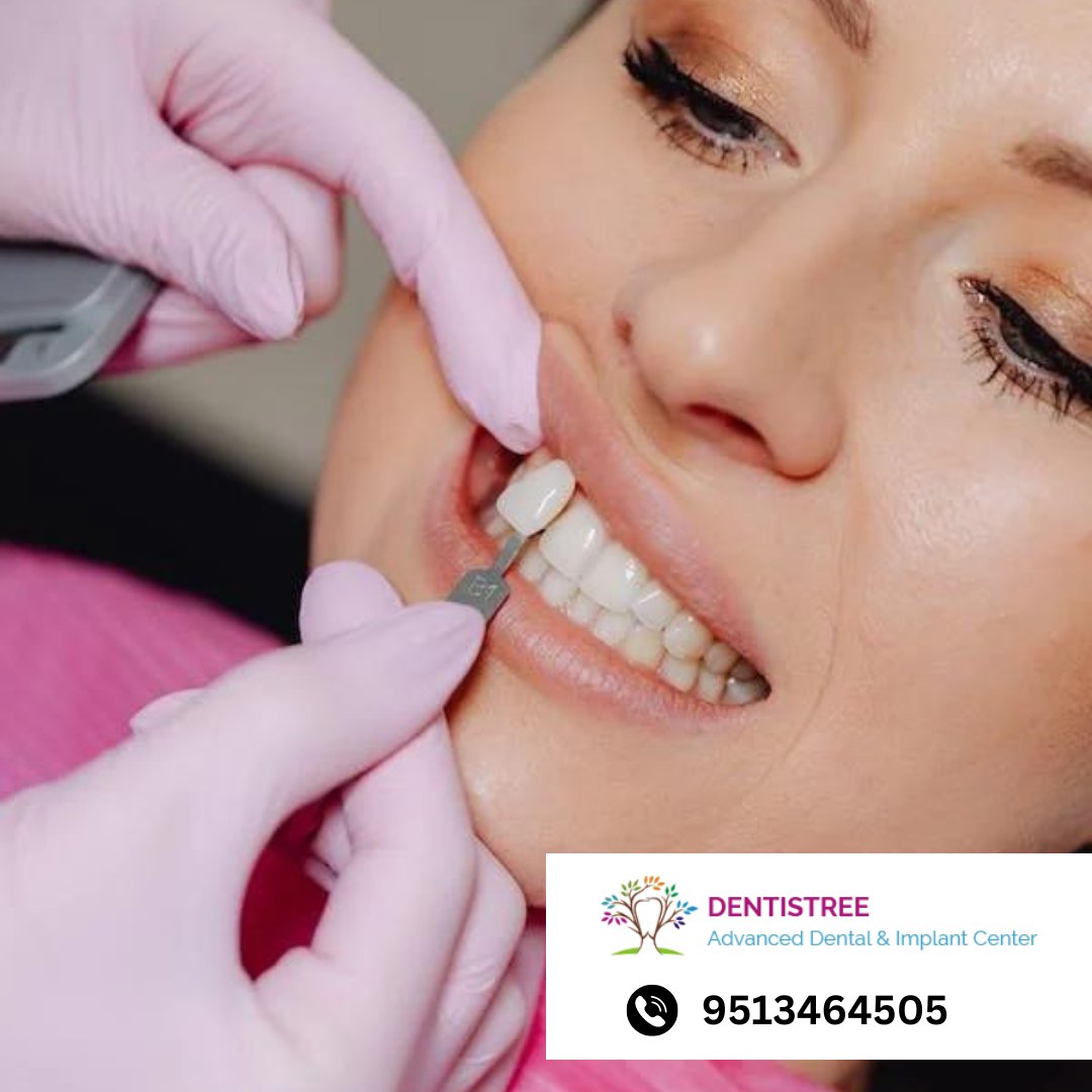 dentistree2's tweet photo. #treatment and #procedures 🦷🦷

Visit us: https://t.co/jtSgx9mZ6n

#bangaloredentist #bestdentalclinic #smile #smiledesigning #dentalimplants #bestdoctor #bestclinic #advanceddentistry #bestdentalclinic #dentalphotography #bangalore #clinic #teethwhitening #dentistree #Dentist https://t.co/F8wEuH9BGV