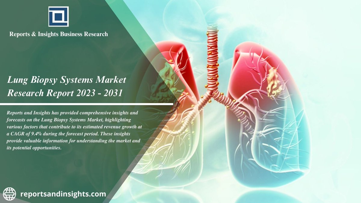 Lung Biopsy Systems Market Research 2023: The Worldwide Demand and Grow Analysis 2031

𝒎𝒐𝒓𝒆 𝒊𝒏𝒇𝒐:- bit.ly/3MBSadd

#marketgrowth #marketsize #marketdemand #marketforecast #marketshare #industryinsights #industryanalysis #marketstudy #marketresearch