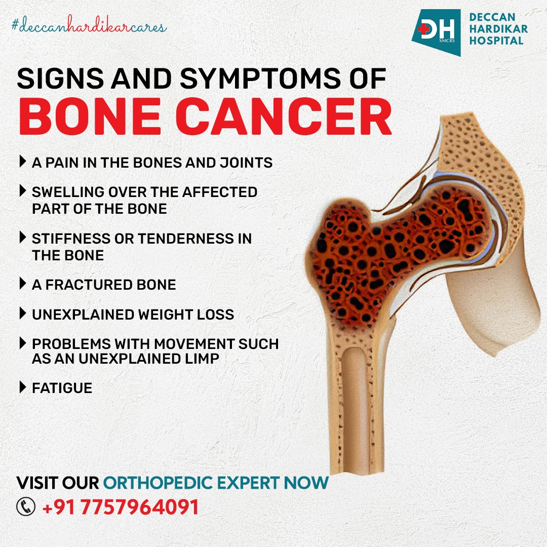 Contact us today at 7757964091 to schedule an appointment with our experts if you have any pain or discomfort, or go to deccanhospital.in
#deccanhardikarcare #pune #punecity #boness #multispecialityhospital #bonecancer #cancer #shivajinagar #pune #deccanhardikar