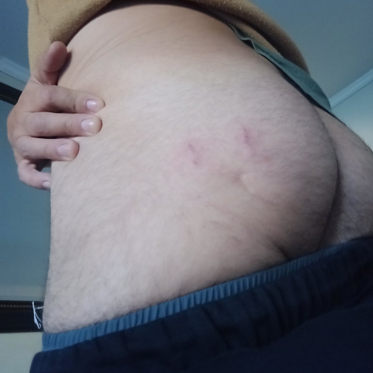 Nocturno_pase's tweet photo. Parece q dormí con un vampiro ... Buen viernes para todos ... Tremendo mordisco que me dejó en el cachete y no me había dado ni cuenta #gay #gaychile #historiasgay #OFchile #bisexual https://t.co/PK01QmLDqW