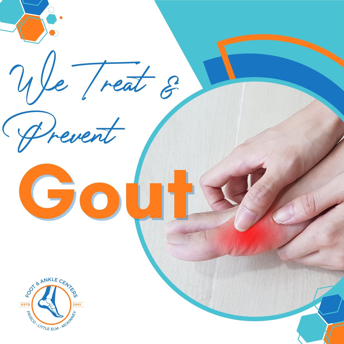 Our treatment for gout prevention may include:
Medication to lower uric acid levels
Anti-inflammatory
Immobilization with walking cast or crutches
Surgery to drain tophi

#gout #gouttreatment #foothealth #footcare #footandankle #frisco #texas #mckinney #littleelm #podiatrist