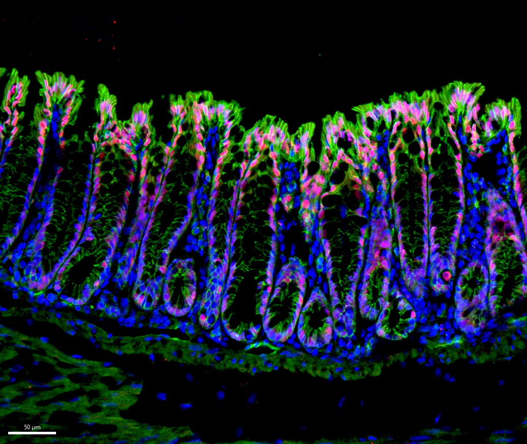 Adult mouse colon stained for SATB2 (red) and CDH1 (green) and DAPI (blue). #FluorescenceFriday #cellbiology #sciart #bioart