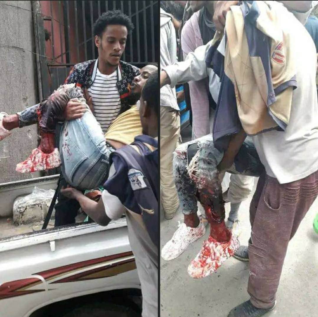 Ekram – إكرام 🇪🇹🇸🇦🇦🇪🖤 (@bintwollo) on Twitter photo ለመስጂድ የተከፋለ ደም‼
በሀይማኖታችን አይደለም መቁሰልን ሞትም ከመጣ በፅጋ ነው ምንቀበለው ሁሉንም መስዋት ለመክፈል ወደሗላ ማንል ነን 
ወላሂ የሚከፈለውን ዋጋ ሁሉ እንከፍላለን‼️
@1EthiopiaTekdem <a href="/sitty_mu/">Sitty</a> <a href="/FoziMay/">Fözï💎</a> <a href="/Harlla6th/">Ibrahim Osman</a> ለመስጂድ የተከፋለ ደም‼
በሀይማኖታችን አይደለም መቁሰልን ሞትም ከመጣ በፅጋ ነው ምንቀበለው ሁሉንም መስዋት ለመክፈል ወደሗላ ማንል ነን 
ወላሂ የሚከፈለውን ዋጋ ሁሉ እንከፍላለን‼️
@1EthiopiaTekdem <a href="/sitty_mu/">Sitty</a> <a href="/FoziMay/">Fözï💎</a> <a href="/Harlla6th/">Ibrahim Osman</a>