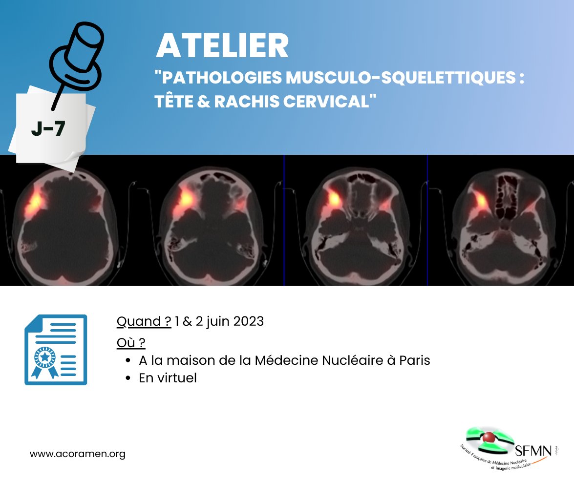 J-7 avant notre prochain atelier : "Pathologies musculo-squelettiques : tête &amp; rachis cervical"
Pour la 22e édition de cet atelier DPC, on aborde une thématique ostéo-articulaire inédite, comme chaque année ! 

Inscription ici : urlz.fr/m0W4