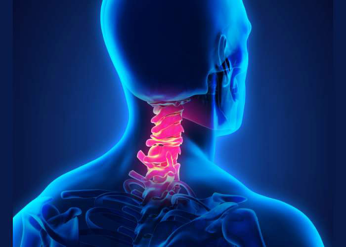 What is cervical laminoplasty?

#Laminoplasty means “lamina reshaping or lamina molding.” This is the most commonly performed in the cervical spine but can also be done in the thoracic or #lumbarspine. medilink.us/xt4x  #spinehealth