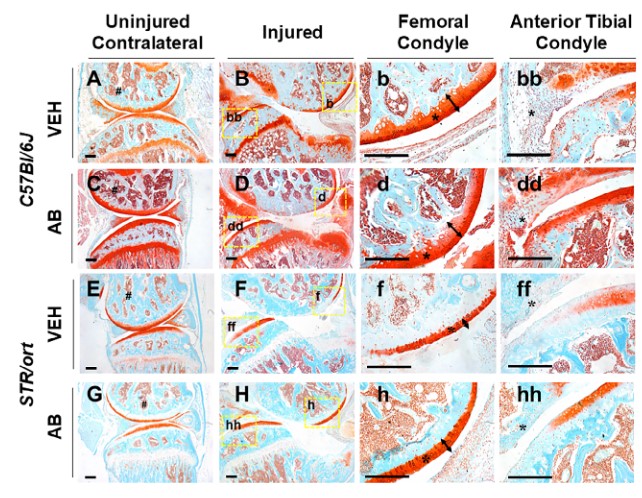 JBMRPlus (@jbmrplus) on Twitter photo Authors from <a href="/UCDavisHealth/">UC Davis Health</a> & <a href="/Livermore_Lab/">Lawrence Livermore National Laboratory</a> found that the effects of LPS administration before injury are also blunted by AB treatment in STR/ort mice #JBMRPlus #openaccess #freetoread <a href="/melaniemendez/">Melanie Mendez, PhD</a> <a href="/GabrielaLoots/">Gaby Loots</a> <a href="/LootsLab/">Loots Lab</a> @ChristiansenLab
ow.ly/IszA50OxX6r Authors from <a href="/UCDavisHealth/">UC Davis Health</a> & <a href="/Livermore_Lab/">Lawrence Livermore National Laboratory</a> found that the effects of LPS administration before injury are also blunted by AB treatment in STR/ort mice #JBMRPlus #openaccess #freetoread <a href="/melaniemendez/">Melanie Mendez, PhD</a> <a href="/GabrielaLoots/">Gaby Loots</a> <a href="/LootsLab/">Loots Lab</a> @ChristiansenLab
ow.ly/IszA50OxX6r
