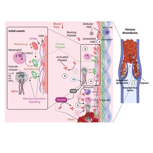 RPTH (@rpthjournal) on Twitter photo LIVE NOW: <a href="/Salles_Crawley/">Isabelle Salles-Crawley</a> presents an #ISTH2023 State of the Art Address on #platelets and #neutrophils in the mechanism of #immunothrombosis. #DVT #VTE <a href="/TheBHF/">British Heart Foundation</a> <a href="/StGeorgesUni/">St George's, University of London (1752-2024)</a> <a href="/ImperialImmuno/">Imperial Department of Immunology & Inflammation</a> <a href="/BritSocHaemThro/">British Society for Haemostasis & Thrombosis</a> <a href="/plateletsociety/">The Platelet Society</a> isth.org/23Capsules #CoagCapsule LIVE NOW: <a href="/Salles_Crawley/">Isabelle Salles-Crawley</a> presents an #ISTH2023 State of the Art Address on #platelets and #neutrophils in the mechanism of #immunothrombosis. #DVT #VTE <a href="/TheBHF/">British Heart Foundation</a> <a href="/StGeorgesUni/">St George's, University of London (1752-2024)</a> <a href="/ImperialImmuno/">Imperial Department of Immunology & Inflammation</a> <a href="/BritSocHaemThro/">British Society for Haemostasis & Thrombosis</a> <a href="/plateletsociety/">The Platelet Society</a> isth.org/23Capsules #CoagCapsule