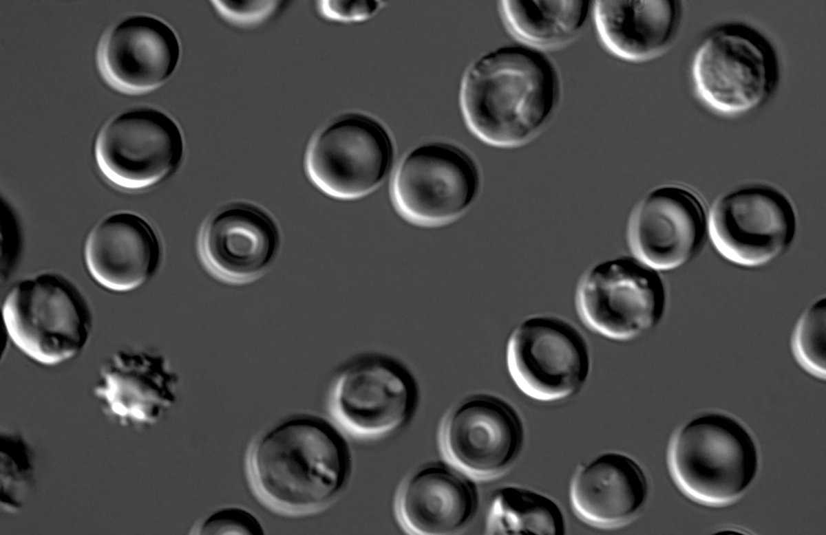 Blood cells photographed through a DIC microscope. #CellBiology