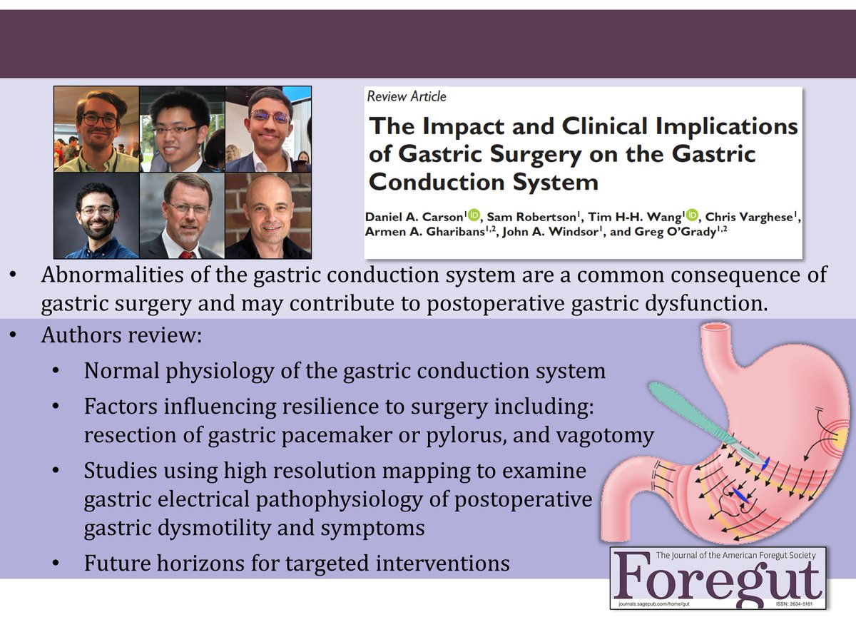 The Impact and Clinical Implications of Gastric Surgery on the Gastric Conduction System by Drs. <a href="/d_a_carson/">Daniel Carson</a> Sam Robertson, Tim Wang <a href="/chrisvarghese98/">Chris Varghese</a> Armen Garibans <a href="/jwindsor3/">John A Windsor</a> &amp; <a href="/ogrady_greg/">Greg O'Grady</a>

📕Read here: journals.sagepub.com/doi/abs/10.117…

<a href="/Akld_Surgery/">Auckland Surgery</a> <a href="/Alimetry_Ltd/">Alimetry</a>  <a href="/AucklandUni/">University of Auckland | Waipapa Taumata Rau</a>