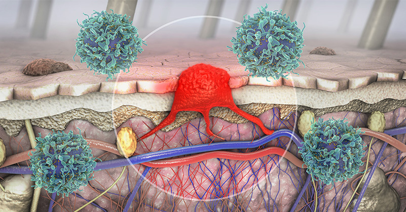 Heading to #ASCO23? Join us for a MasterClass and Case Forum on next-gen immunotherapies in #melanoma on June 3. Get all the details and register today for this 6/3 6:30 PM CDT live event with @jasonlukemd, @MeredithMcKean, & Dr. Kendra: bit.ly/2023Melanoma #OncoTwitter