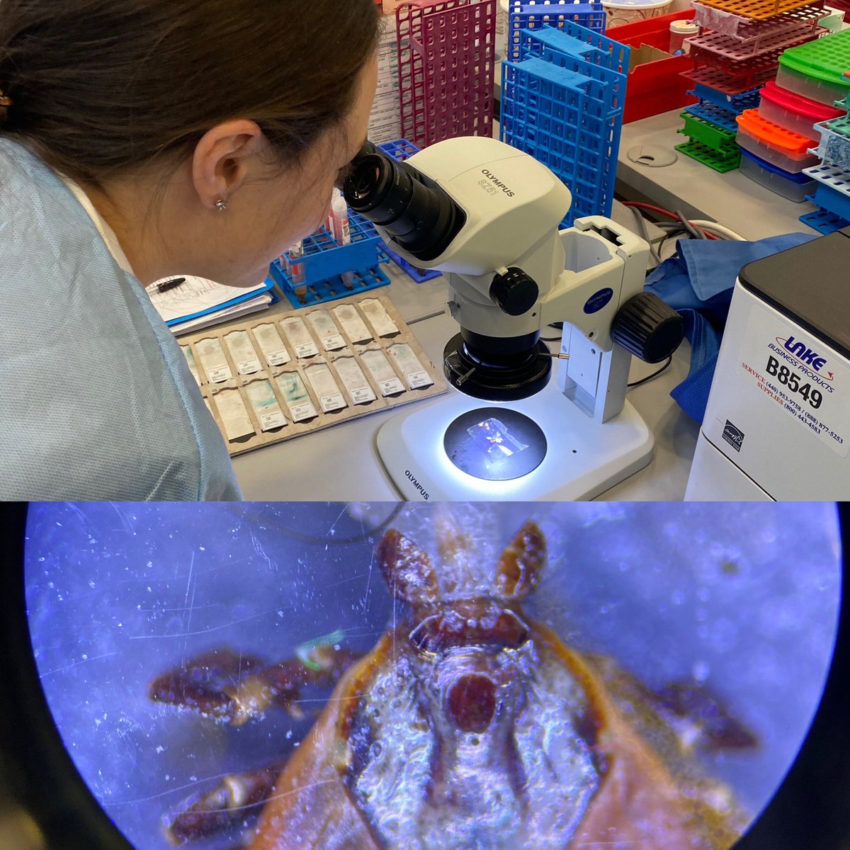 When you are thinking microbiology do you think bacteria? Fungi? Most people do. We also practice parasitology in our micro labs! Ticks, bedbugs, nematodes, trematodes, single cellular, multicellular, we do it all! #wegetresults #lablife #microbiology #parasitology #labucate