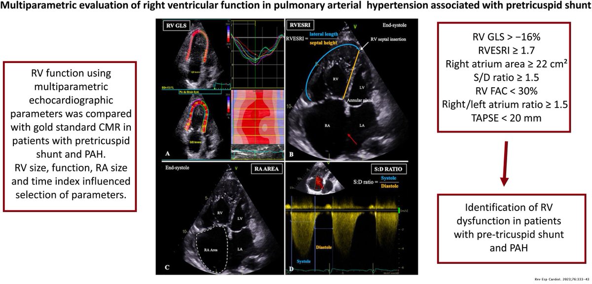 RevEspCardiol's tweet photo. Multiparametric evaluation of right ventricular function in pulmonary arterial hypertension associated with congenital heart disease #REC #Cardiotwitter https://t.co/04HgFtSn2u https://t.co/CYwN3GWrz9