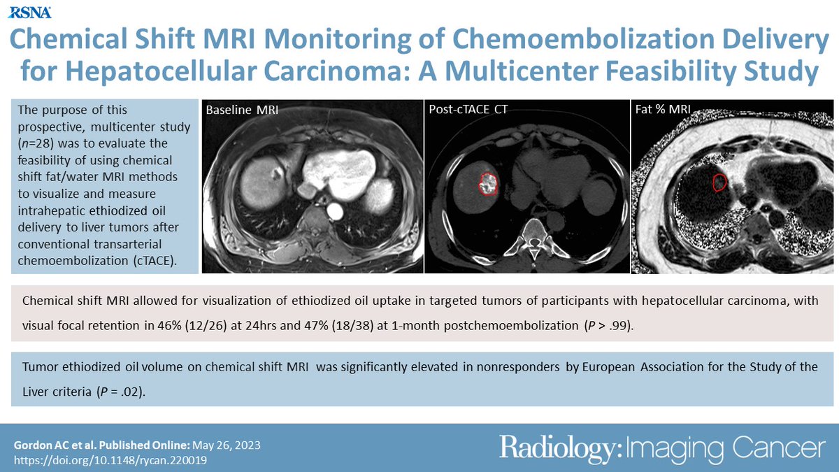 Excited to bring you the latest issue of Radiology: Imaging Cancer! pubs.rsna.org/journal/imagin…. Highlighting original research articles. Chemical Shift MRI Monitoring of Chemoembolization Delivery for Hepatocellular Carcinoma: Multicenter Feasibility of Initial Clinical Translation