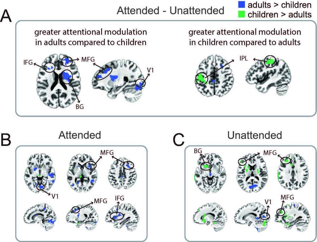 SfNJournals's tweet photo. #JNeurosci: @yaelanjung, @tessforest, @DirkBWalther, and @amysuefinn @UofT show that attention works differently in children's brains compared to adults', likely allowing children to learn about facts that are not immediately relevant for a task.
https://t.co/zoUHeD5ERC https://t.co/KjJ6HprEKo