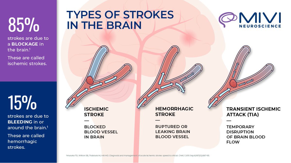 MiviNeuro's tweet image. #StrokeAwareness: Understanding the types of stroke is crucial! Recognizing the signs early can make a life-saving difference. Stay informed, spread awareness, and help prevent strokes! #KnowTheStrokeTypes #StrokeAwarenessMonth