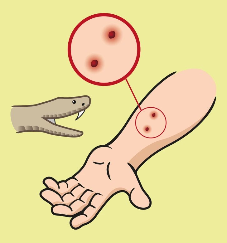 DOITSAVOIR's tweet photo. Voici un guide des premiers soins de base que tout le monde devrait connaitre après la morsure de serpent. https://t.co/0Sbd5W9wzv
