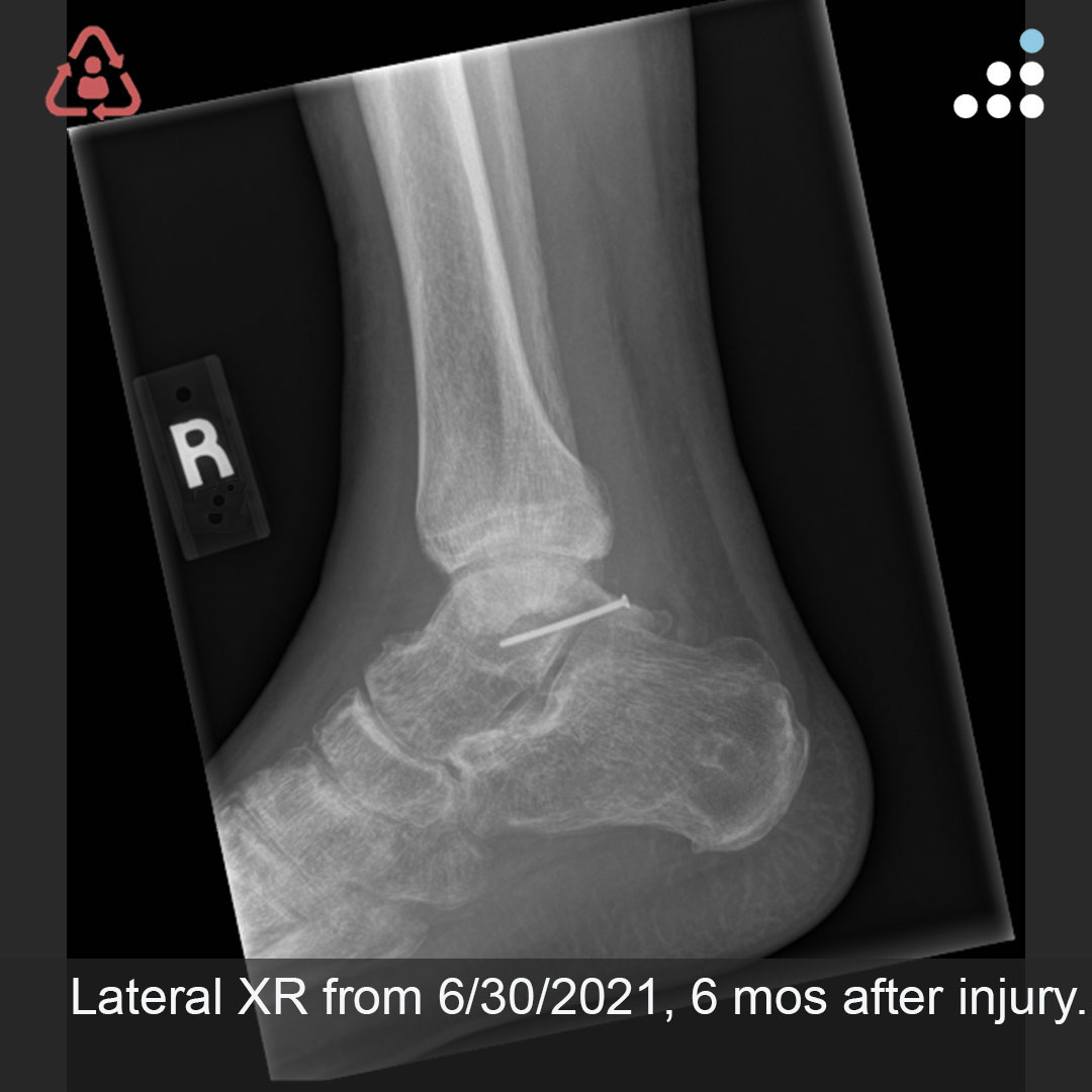 Orthobullets tweet media