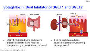 Breaking news: FDA has just approved sotagliflozin (brand name 'Inpefa') for Treatment of Heart Failure!!!!

Broad label across full LVEF range (HFpEF&HFrEF), and for patients with or without T2DM

First dual SGLT1/2 inhibitor to be approved in HF

@DLBHATTMD @ChristosArgyrop