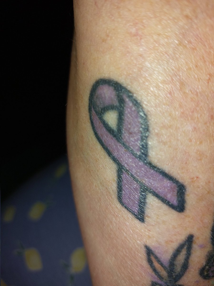 @life_stoma Here's mine, had it about 7 yrs #purpleribbon #uc #nocolonstillrollin #ibdwarrior 💜