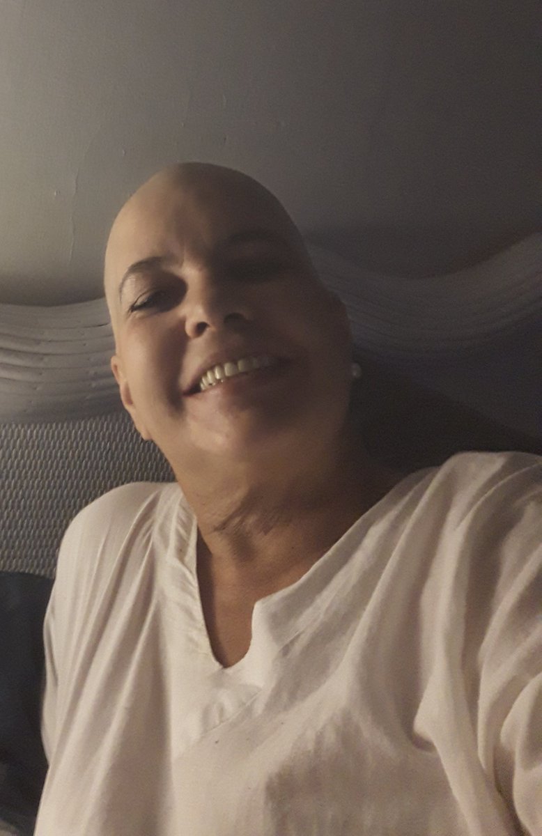 Ya en esta etapa! Que si me importa? Ya no.que si lloré mucho! Pero ya pasó. Mi vida vale más que cabello , estoy fuerte con mucha fe!! Alegre y aceptando esta prueba  una más. Y Dios me dará la victoria.vamos que si puedo.gofund.me/d66c1ea5