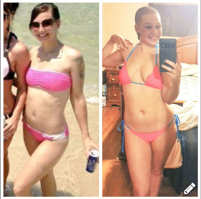 22 vs 32. It only took 10 years, 50 lbs, and a drastic haircut to finally feel F*CKING GORGEOUS in my<a href="/tag/bikini"class="tags"><span>#bikini</span></a><a href="/tag/sexy"class="tags"><span>#sexy</span></a><a href="/tag/bikinibody"class="tags"><span>#bikinibody</span></a><a href="/tag/alternativemodel"class="tags"><span>#alternativemodel</span></a><a href="/tag/thickthighs"class="tags"><span>#thickthighs</span></a>