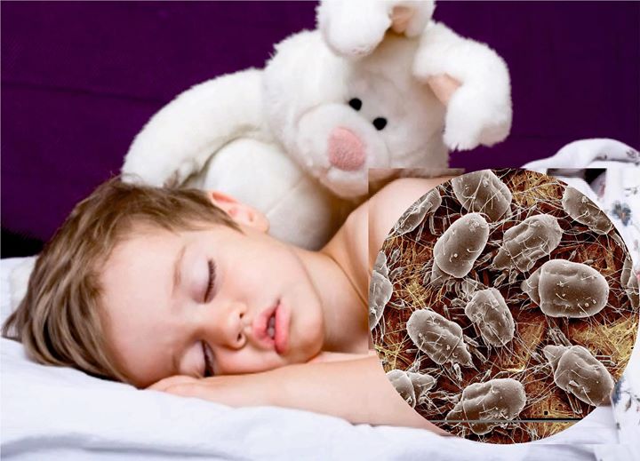 Algunos bebés y niños suelen toser por la noche, justo al acostarse y posteriormente al levantarse, además de tener fluido nasal constante y congestión nasal persistente.

Estos niños con frecuencia son tratados como si tuvieran infecciones frecuentes, reciben tratamiento con