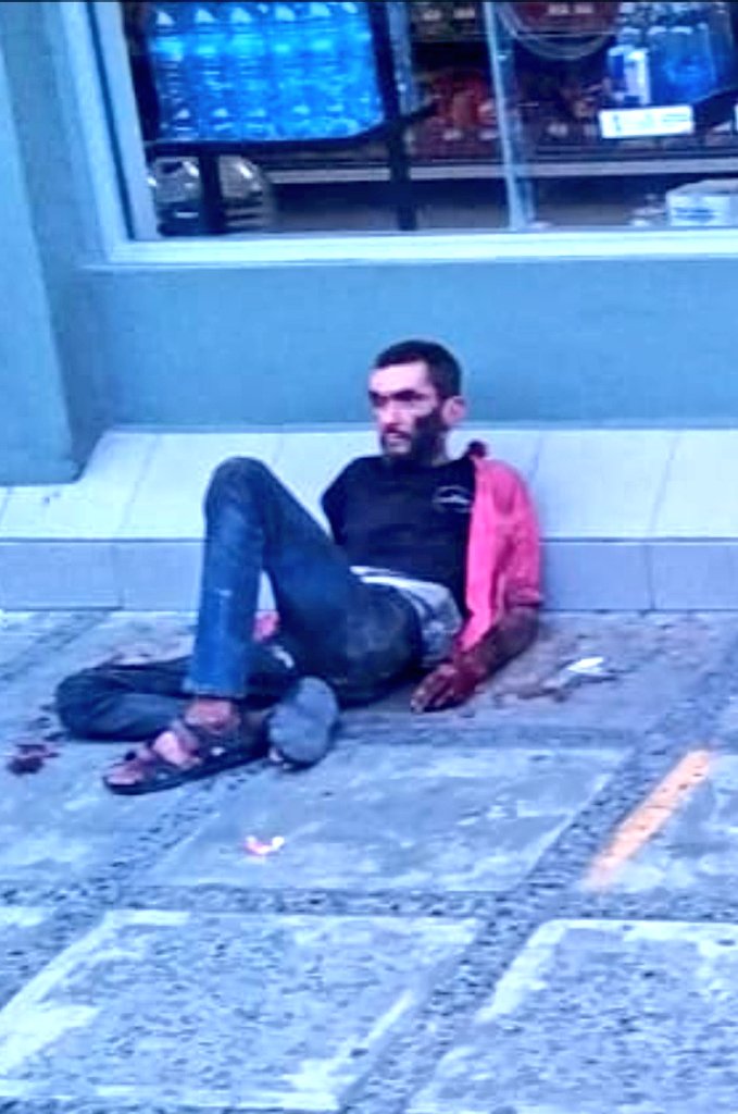 ChismitoJarocho's tweet image. #ChismitoJarocho 📷 6:23 pm 🚨 ALERTA 🚨 Reportan persona en situación de calle lesionada (sangrando) de la cabeza en Lafragua y Tuero Molina en el puerto de Veracruz. @AyuntamientoVer @PatyYunes #VeracruzPuerto #Jarochos #Veracruz2023 @CruzRojaVerBoca