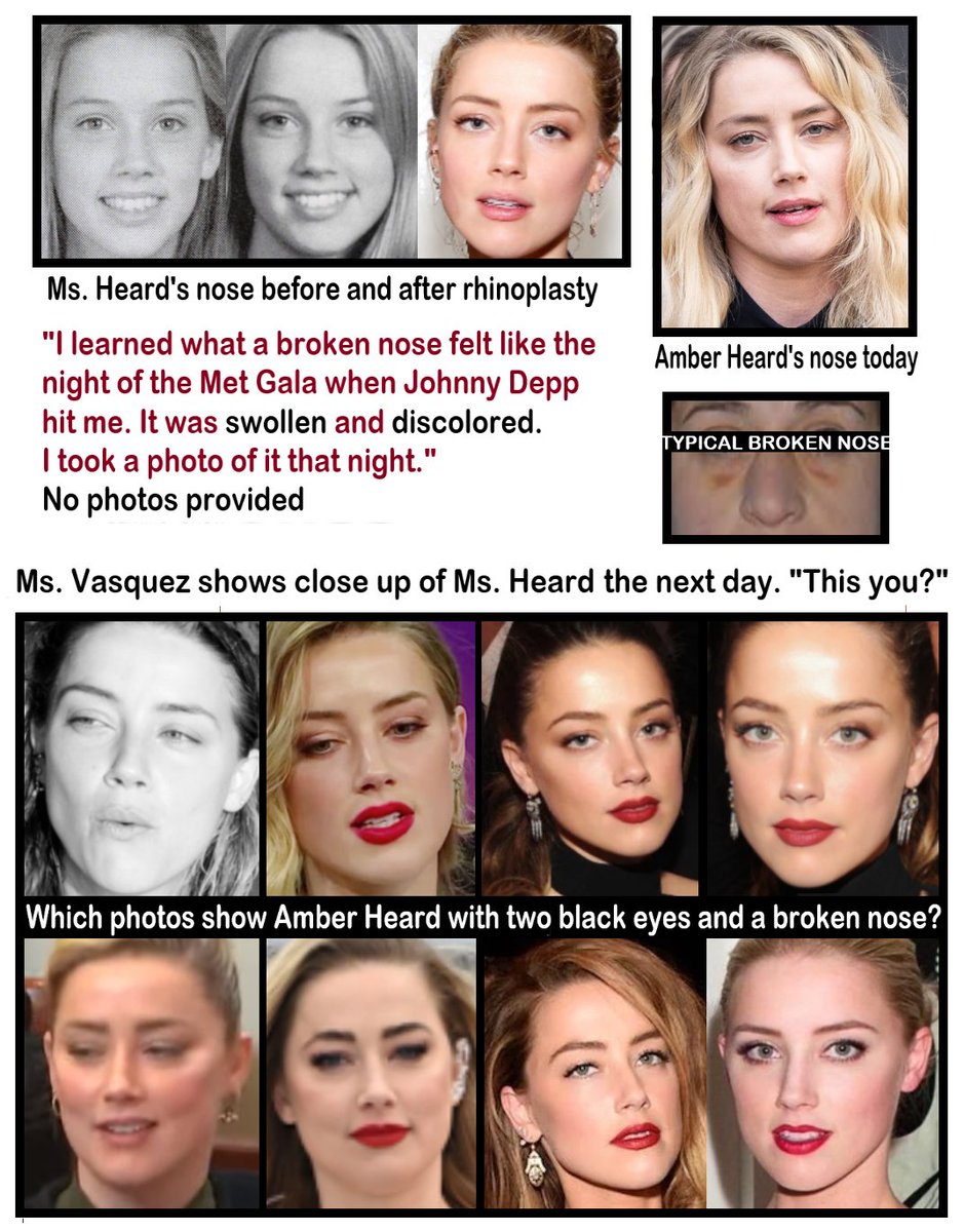 Would you like to play a game? Can you identify which 4 photos show AH with 2 black eyes/a broken nose? AH wants us to believe she never went for medical treatment or asked her cosmetic surgeon about damage? THAT'S why #JohnnyDeppWon.
#AmberHeardIsALiar 
#AmberHeardlsAnAbuser