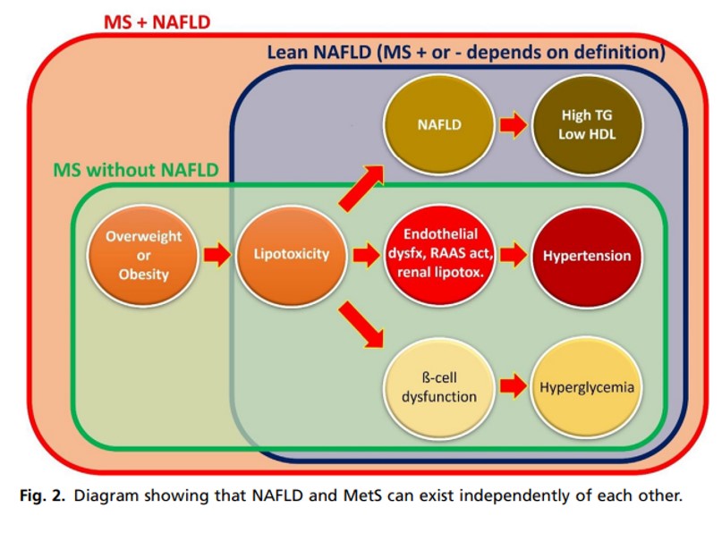 NAFLD and the metabolic syndrome can exist independently of each other. #livertwitter #NAFLD #NASH #lipotoxicity pubmed.ncbi.nlm.nih.gov/37024202/