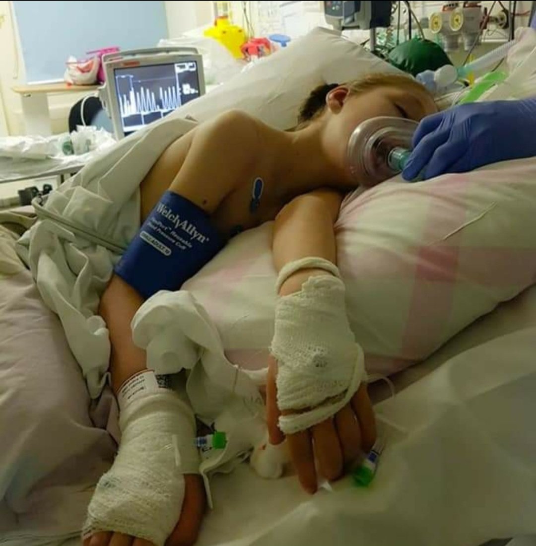 Today we have been told when Teagan's private doctor retires in July there is no replacement! This puts Teagan's life in danger. She needs this medication. Please help us share this. #NHS and #government need to step in. Teagan could end up back like this imminently 💔