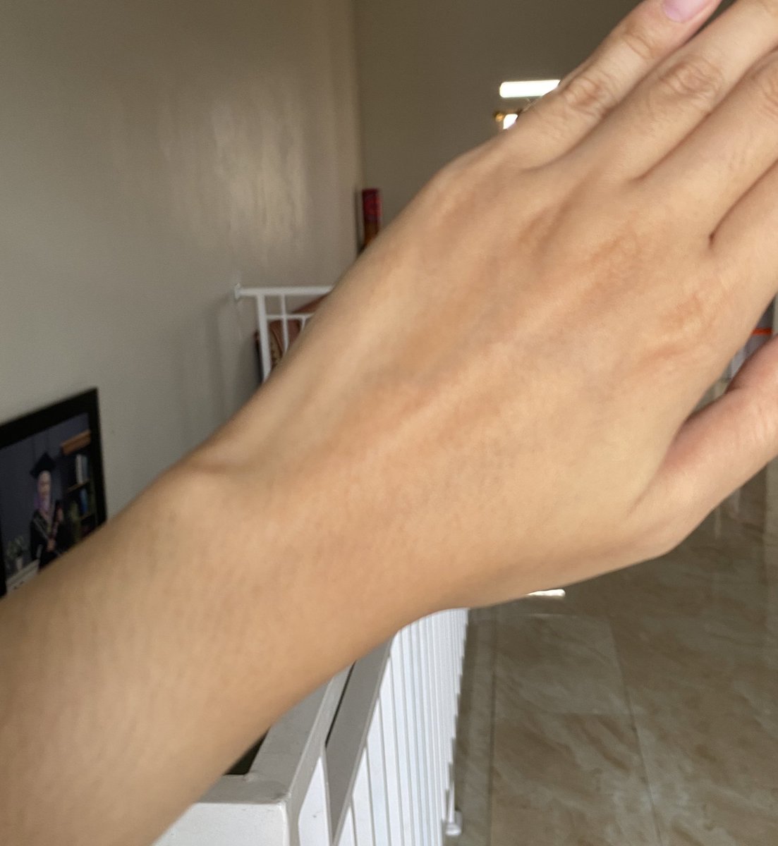 syafinajlza's tweet photo. Akhirnya nemu produk bagus buat ratain warna kulit yang belang!! 😭
Jujur di kota-ku ini emang panas banget, jadi keluar rumah bentar aja bisa bikin kulit kusam dan belang 🥲 iseng cobain @perfectwhite_id dan ternyata cocok 😭
#reviewskincare #perfectwhite #ahabodyserum https://t.co/3mZET8Cp4S
