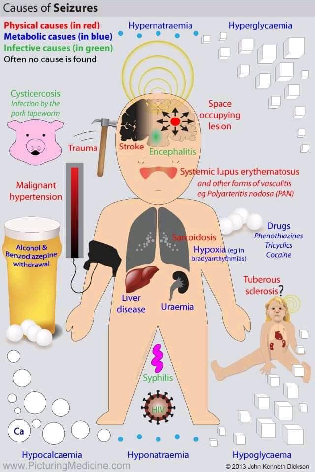 Causes of Seizures

#medtwitter #foamed