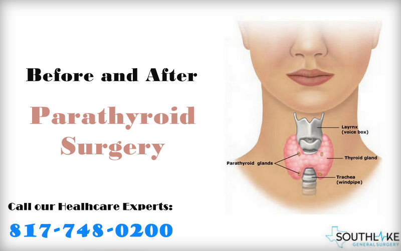 Before and After Parathyroid Surgery: A life-changing journey! 🩺 Say goodbye to fatigue, memory issues, and bone pain. Embrace a healthier, stronger you! 💪🌟 Read more: southlakegeneralsurgery.com/before-and-aft…
#ParathyroidSurgery #NewBeginnings #HealthTransformation #latestnews #Health